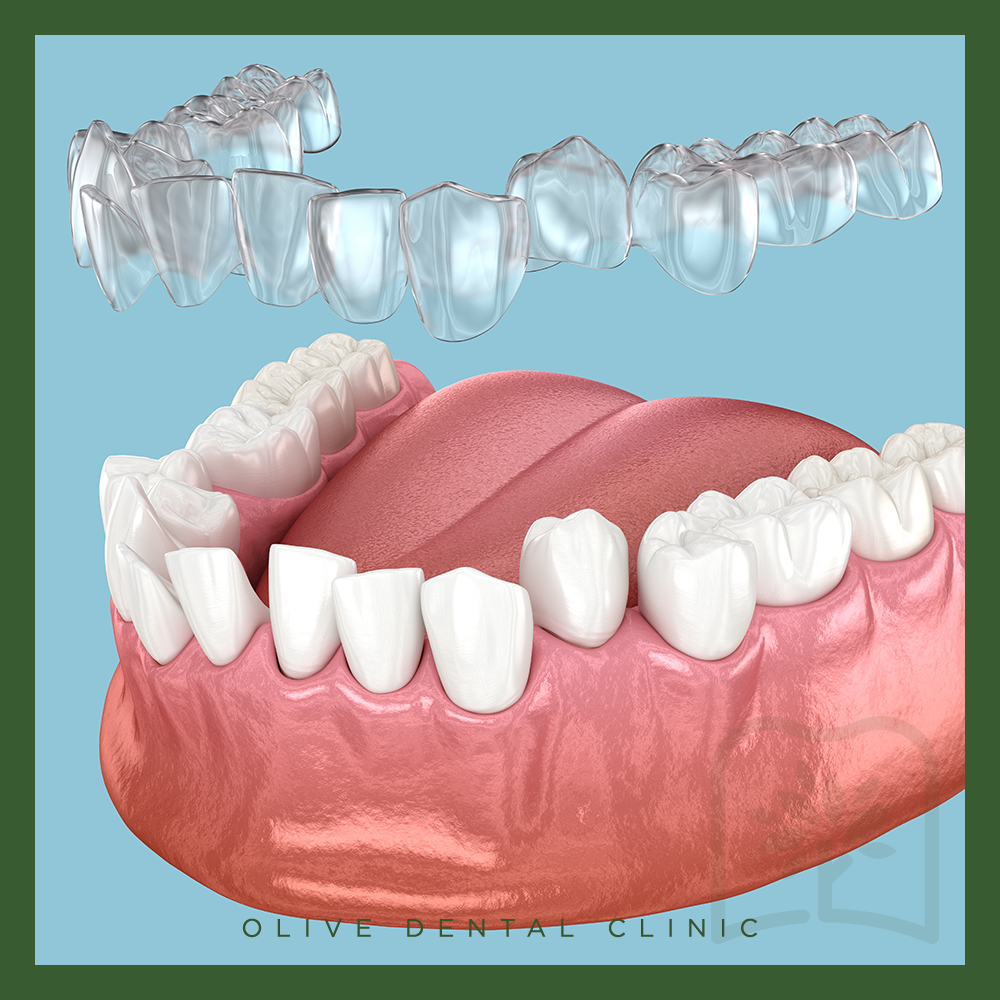 올리브치과 치아교정