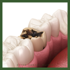 안양역치과잘하는곳