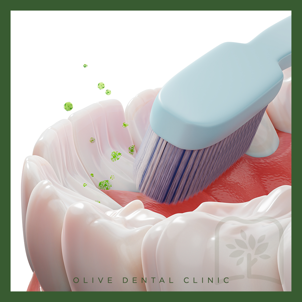 올리브치과 치아교정