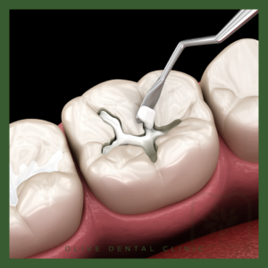 안양역치과잘하는곳