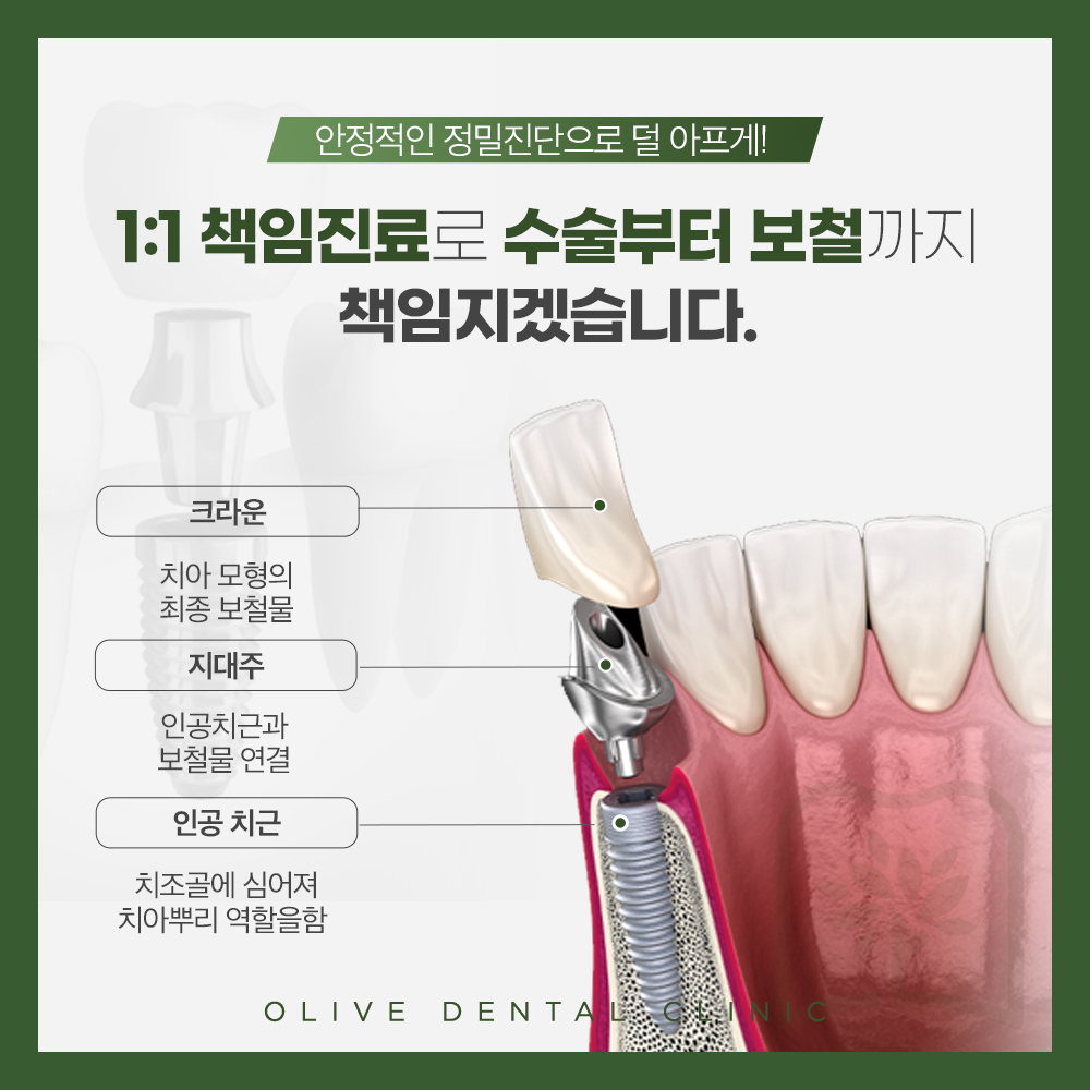 올리브치과 임플란트