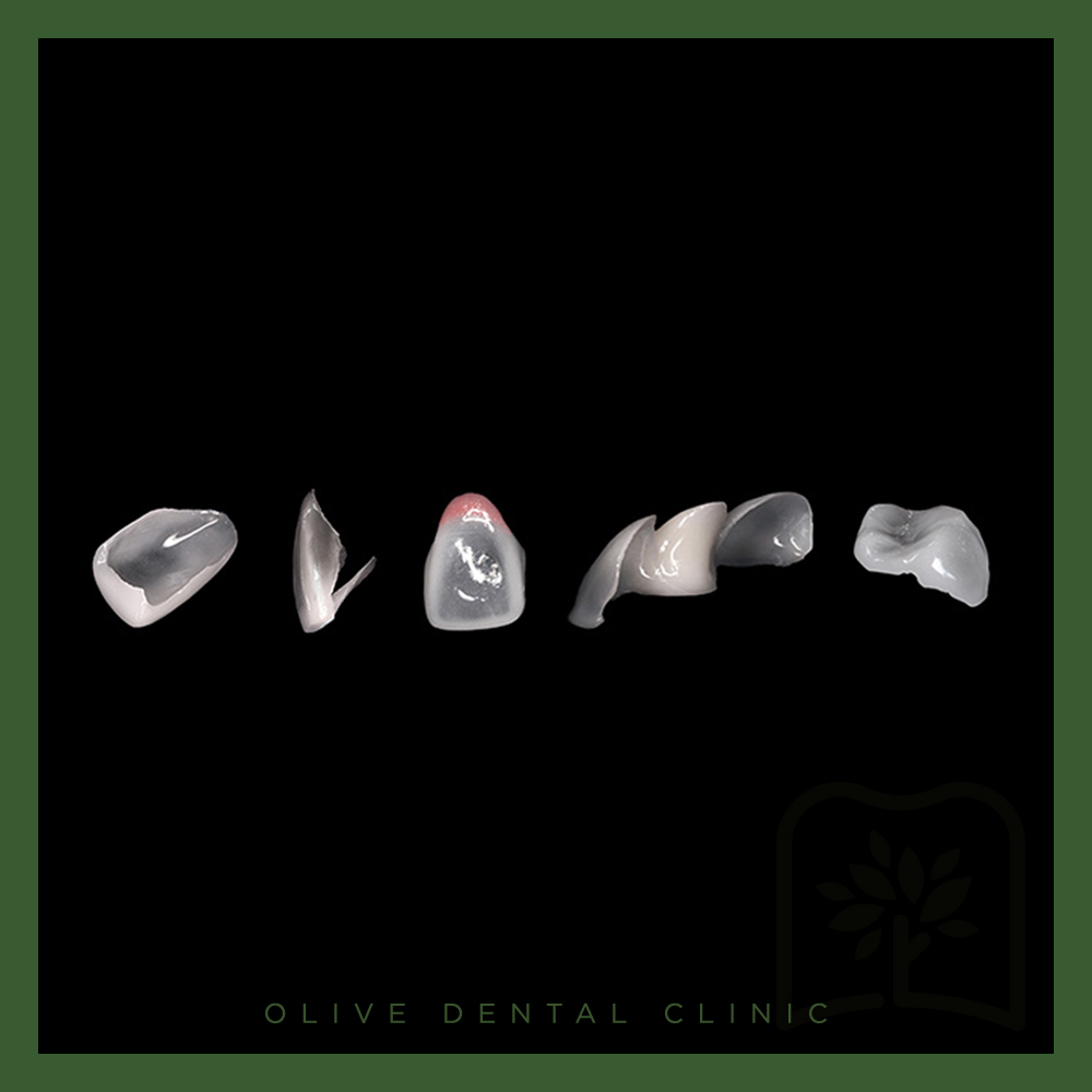 올리브치과 미니쉬치료