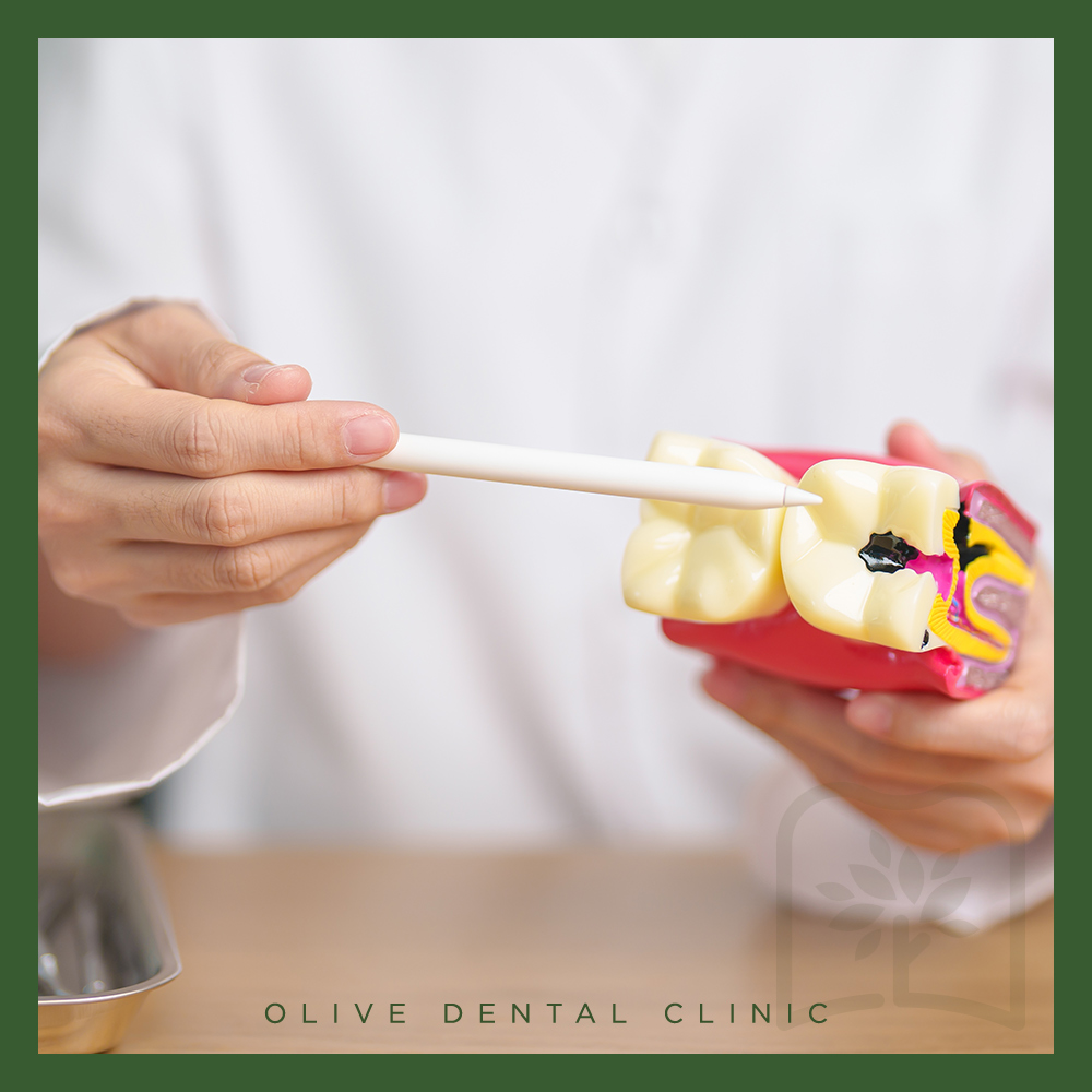 올리브치과 충치치료