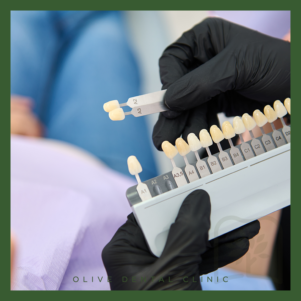 올리브치과 치아미백