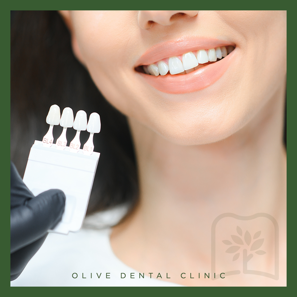 올리브치과 치아미백