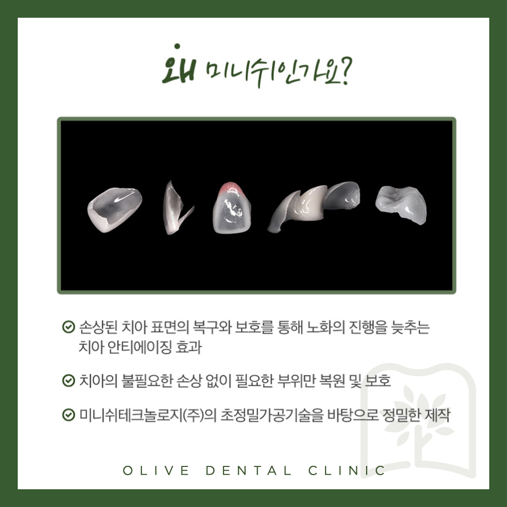 올리브치과 미니쉬솔루션