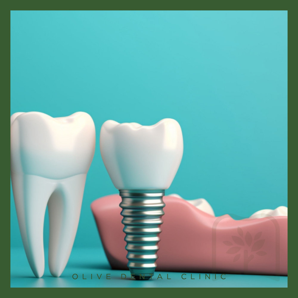 올리브치과 임플란트