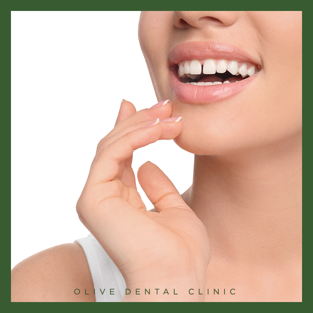 안양비산동치과