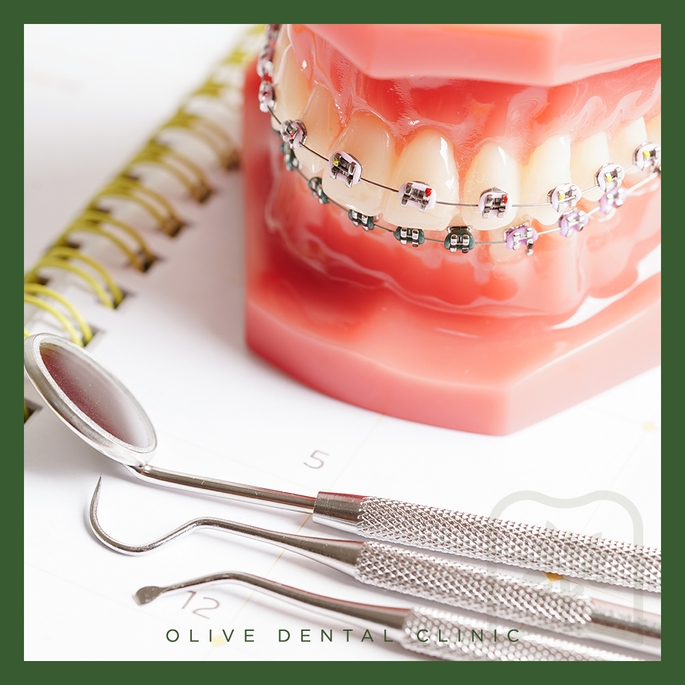 올리브치과 치아교정