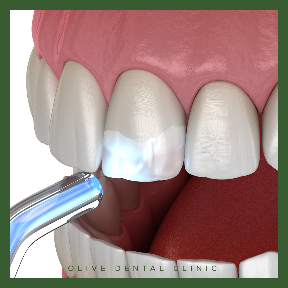 안양비산동치과