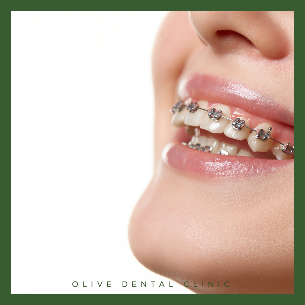 안양비산동치과