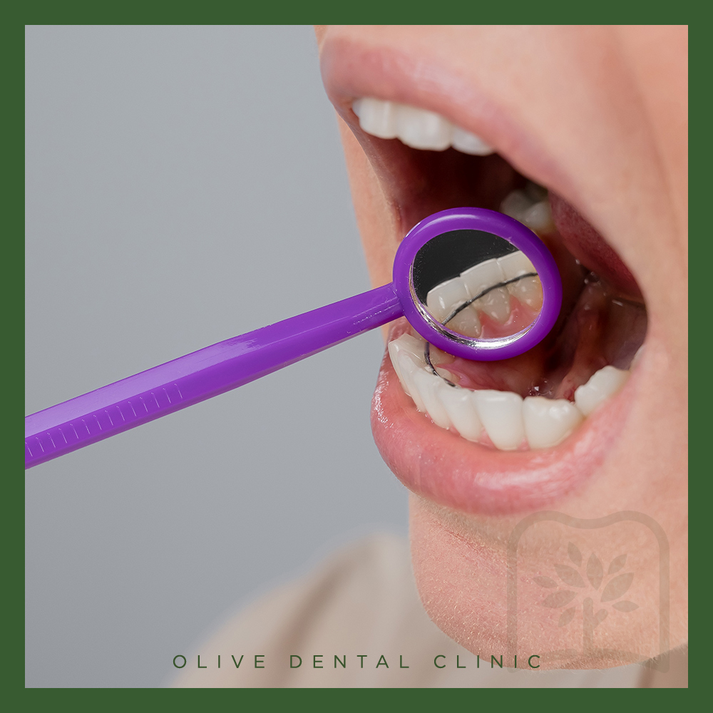 올리브치과 치아교정