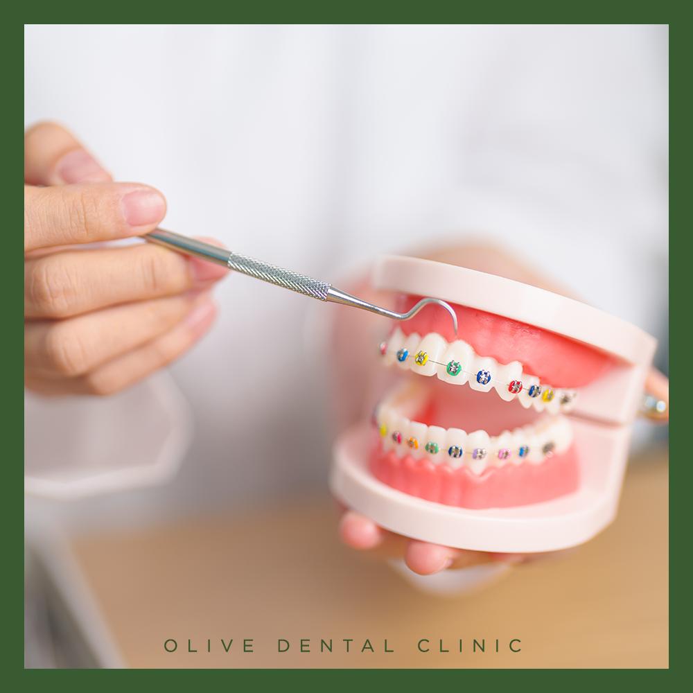 비산동치아교정