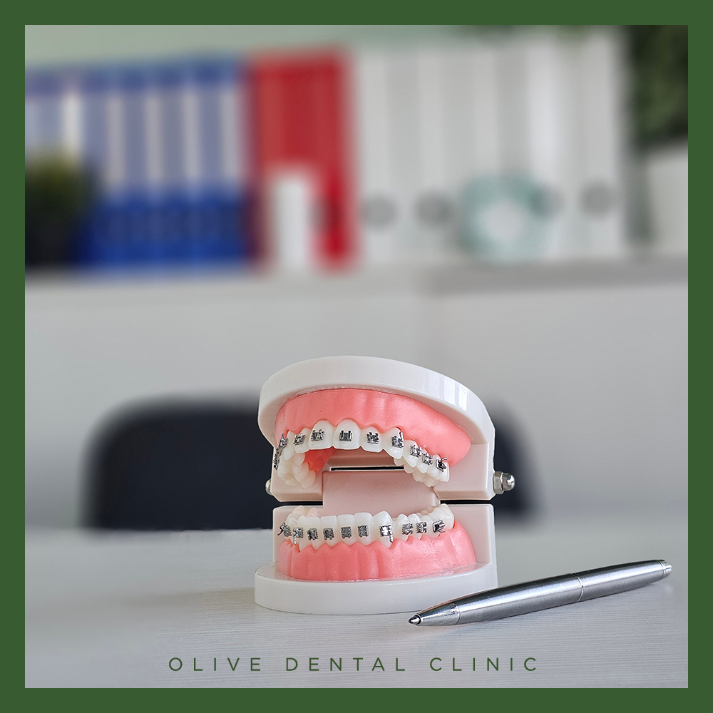 비산동치아교정