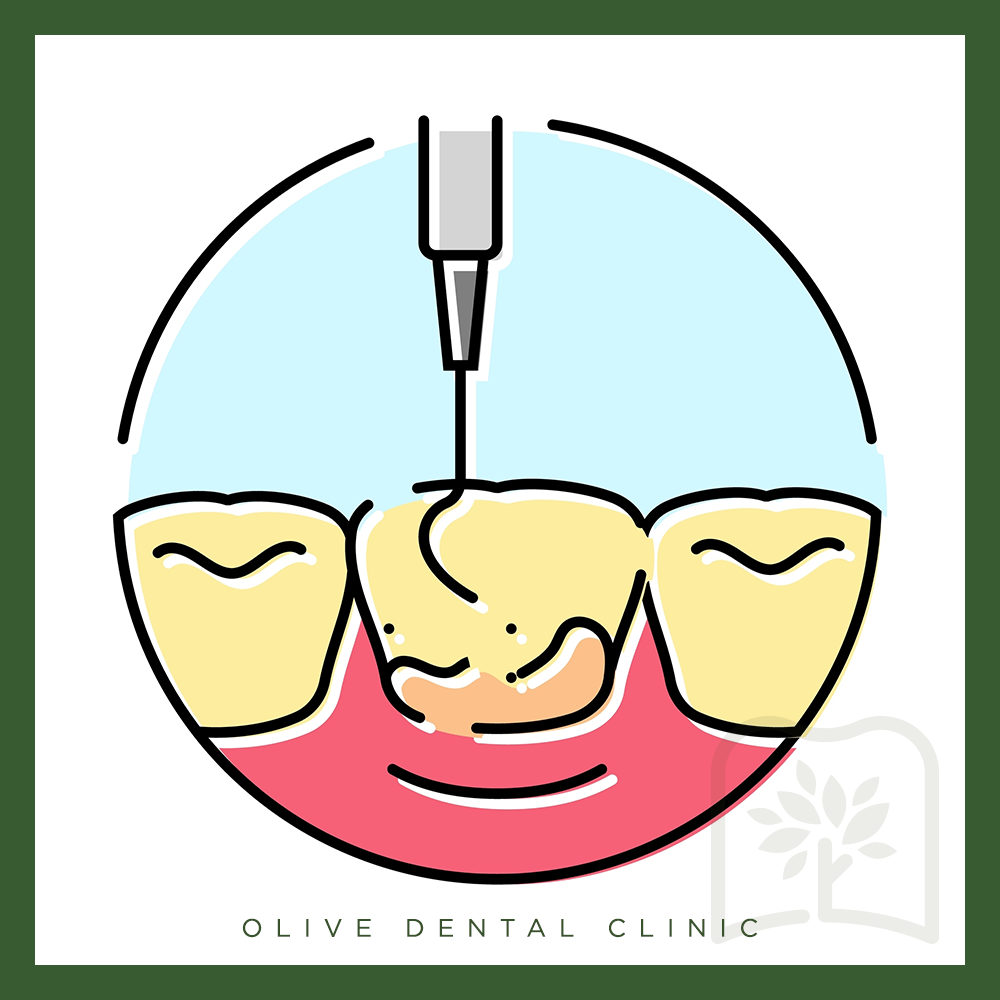 비산동스케일링