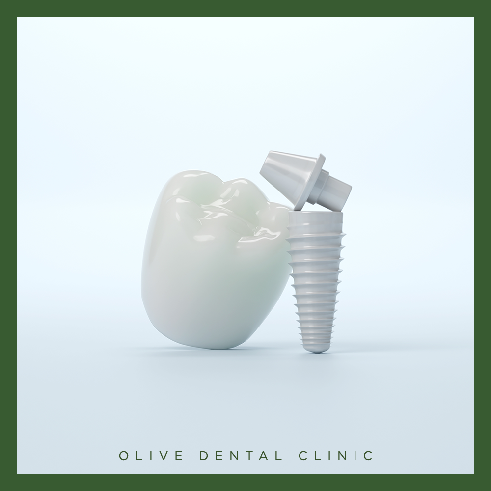 비산동임플란트