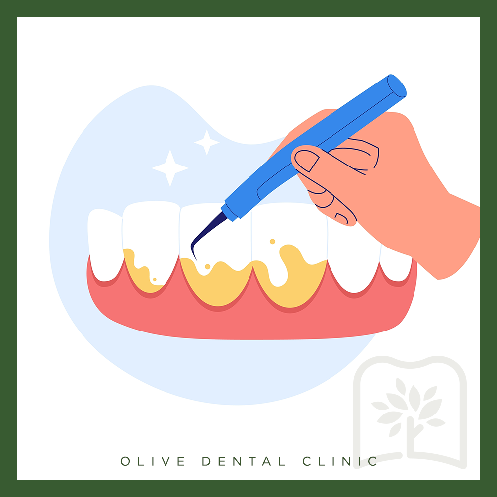 비산동스케일링