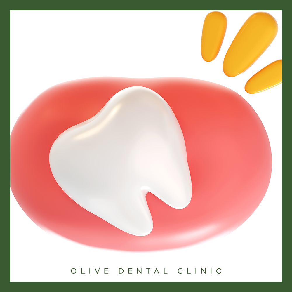 비산동사랑니발치