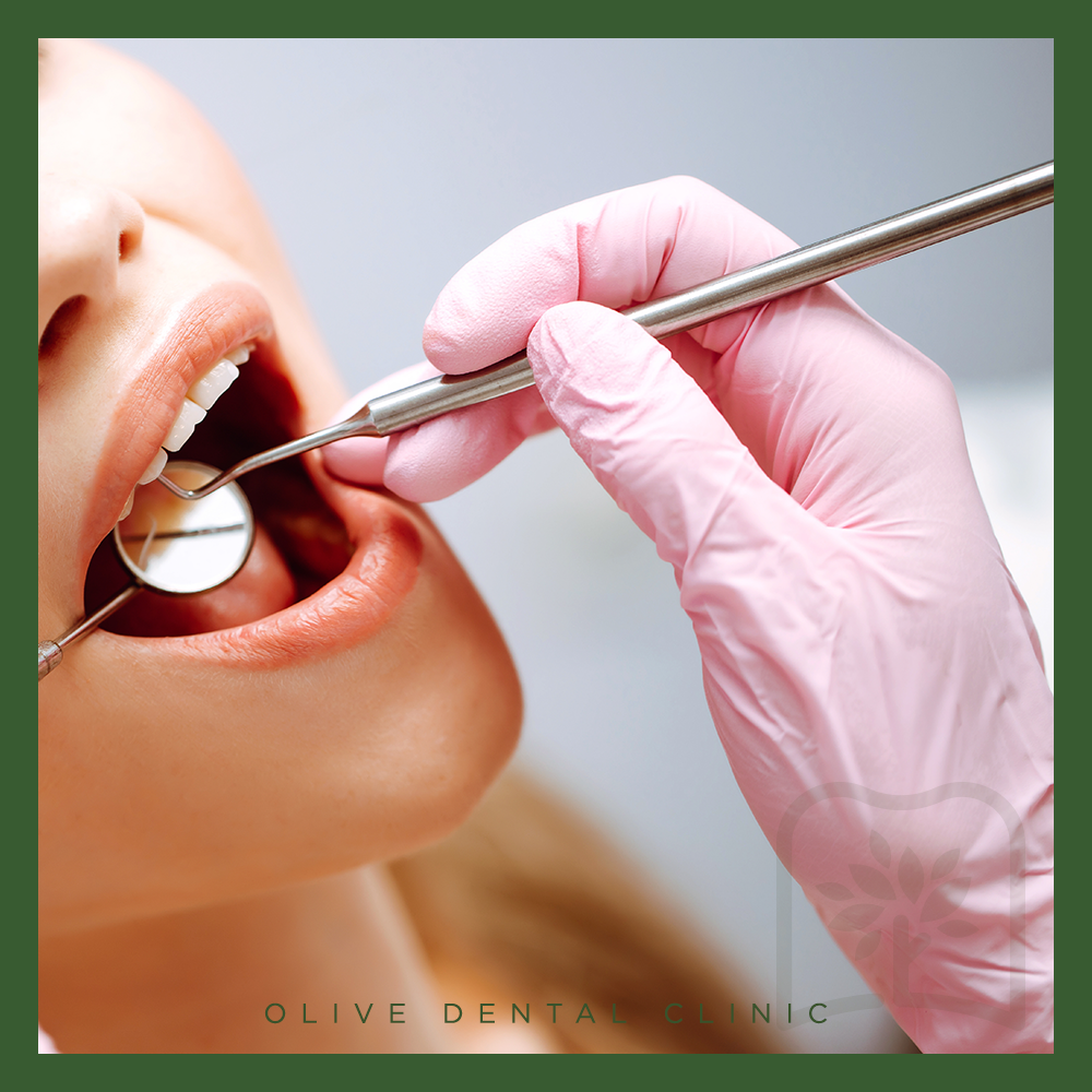 비산동스케일링