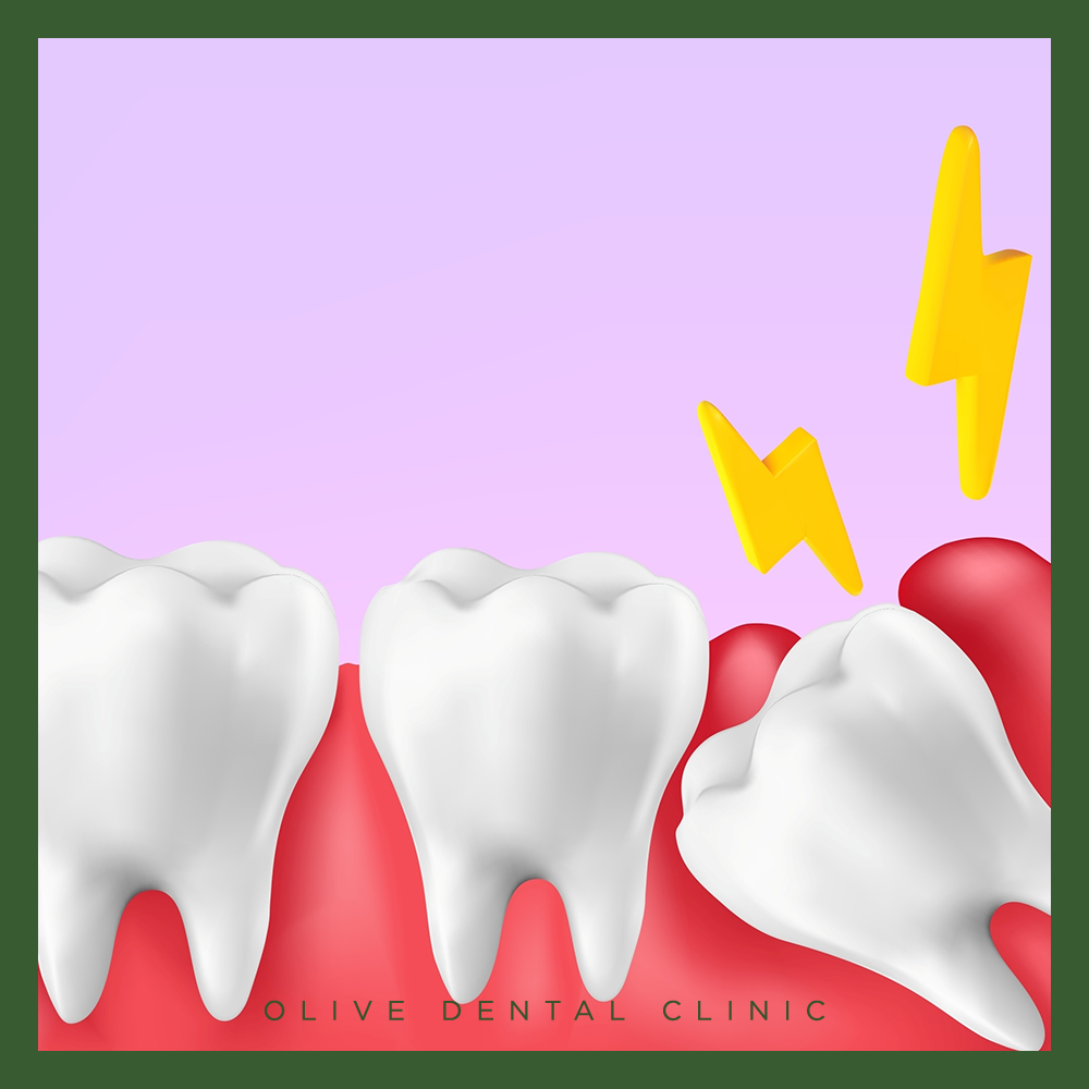 비산동사랑니발치